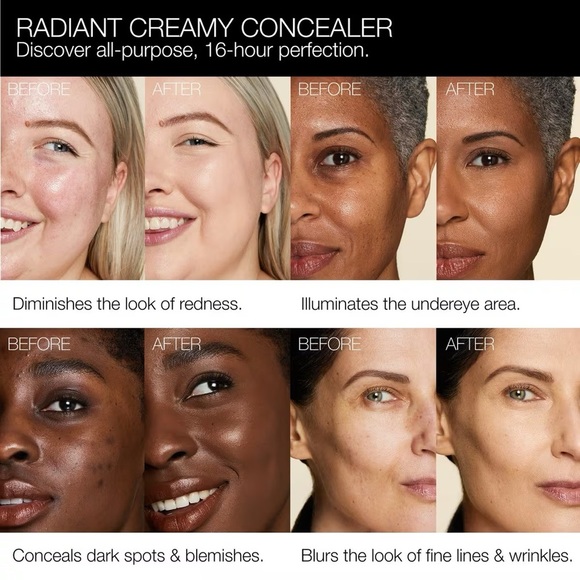 NARS (Medium 1- Custard) Radiant Creamy Concealer - Picture 6 of 12